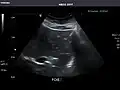 Liver