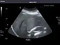 Liver