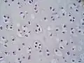 Magnified cross-section of the cartilage of the trachea