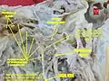Dissection of chorda tympani nerve
