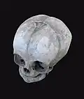 Infant skull