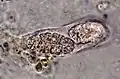 Two muriform spores in an ascus from E. petrolepideum; photographed through a compound microscope, x1000