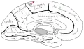 Central sulcus on the medial surface. It divides the paracentral lobule into the anterior part and the posterior part.