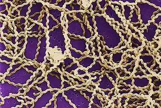 A scanning electron micrograph of several Lepitospira bacteria on a filter