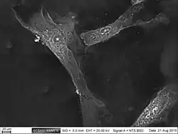 Sparse, elongated cells captured in grayscale on a black background.