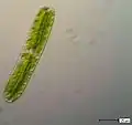 Netrium oblongum.  A saccoderm "desmid"