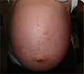 Front view of abdomen