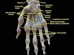 Wrist joint. Deep dissection. Anterior, palmar, view.