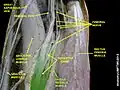 Vastus medialis muscle