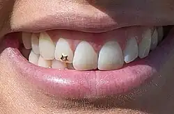 A up-close photograph of a beautiful femme smile, on a tooth just to the left of the front 2 teeth is a small star made of gold with a clear gemstone set inside. The star is much smaller than the tooth, maybe 1/9th as big. The lips are naturally pink and their skin-tone is pale. The photograph is bright as if taken outside.