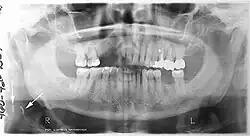 X-ray64A